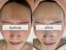 エクレ(eclat)/1回でも驚きの効果実感！