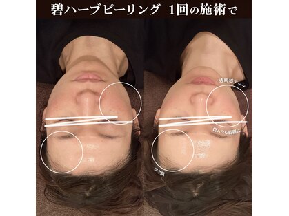 キノセ(kinose)の写真