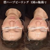 キノセ(kinose)