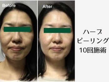 フアリト 江坂店(Fuari-to)/Before After4