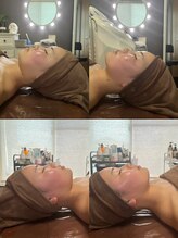 シア スパ(SIA SPA)/小顔コルギビフォアフター