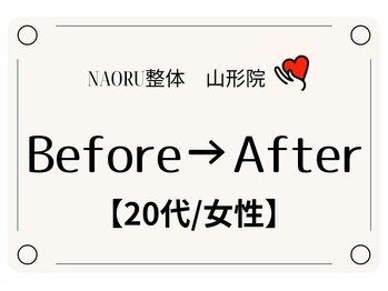 ナオル整体 山形院(NAORU整体)/Before→After【20代/女性】