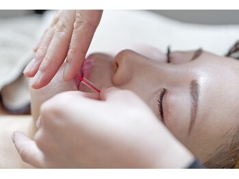 ハリノヒ 本町院/しわ・ほうれい線引き上げ美容鍼