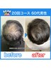 【毎月6名様限定！髪のボリューム対策ケア】初回特別20,000円→2,980円