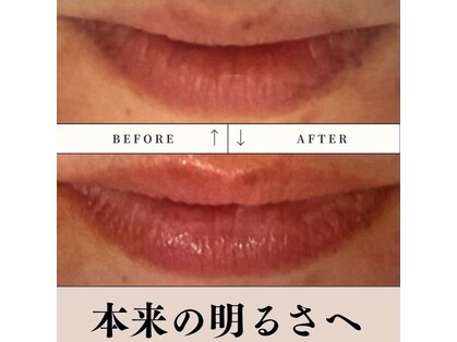 ラリリー(La Lily)の写真