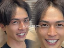 ミュー ブロー(MEW BLOW)