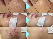 リノミラ(LINOMIRA)の雰囲気(本気で美肌を目指す方に☆ニキビ/毛穴悩みへ結果重視の施術!)