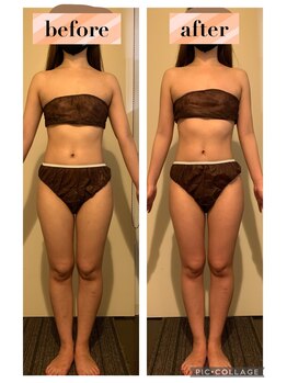 マンダ 田町(Manda)/肩首のコリをしっかりほぐします