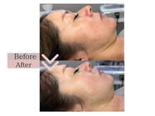 フロリール アザブジュウバン(FlorirAzabujuban)/赤み/くすみ/肌荒れ/シミ/毛穴