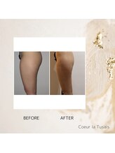 クーラ テュセ(Coeur la Tusais)/下半身集中痩身