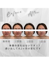サロン ド ナース ユー ソナ(salon de nurse U.sona)/NO針！NO痛！ダウンタイムなし！