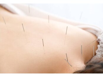 鍼灸院 ＨＡＲＩｅｙｕ/