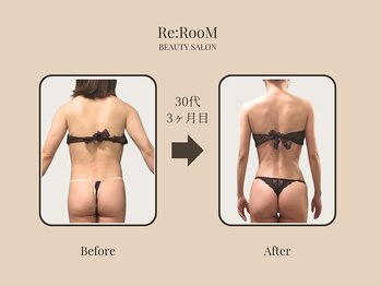リ ルーム(Re:RooM)/痩身Before&After