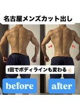 痩身ハイパーナイフメンズ【salon blue rose】新栄町/千種/痩身/ダイエット/脂肪燃焼/名古屋カット出し/メンズ/大会前