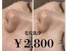 【OPEN記念★鼻の黒ずみ撃退】Tゾーン毛穴集中洗浄 /¥2,800