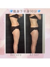 ビューティースタジオ エイワン(A1)/【痩身】Before ＆ After