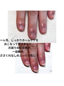 ヴェールリム(verl lim)/