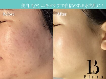 バース(Birth...)の写真