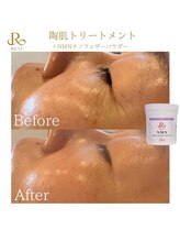 サロン ウーカ(salon WOOCA)/REVI陶肌トリートメント