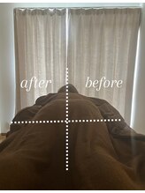 ベルファム(belle femme)/ビフォーアフター