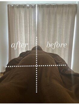 ベルファム(belle femme)/ビフォーアフター