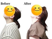 慧仁治療院/首こり・肩こり改善