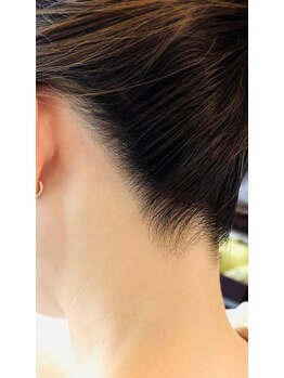 アンバー(unbar.)/シェービング+光脱毛