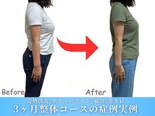 整体院ワト 蒲田院(WATO)/■姿勢矯正整体コースの症例実例