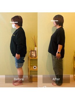 ビーライフ(B Life)/曲がった腰の背筋がシャキッと!
