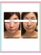 ハリスキンラボ(Hari.Skin.Lab)の写真/お顔の印象が変わる、リフトアップを叶えたい。
