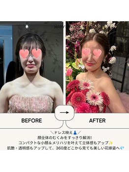マリーズウィル(MARY's WILL)の写真/挙式当日に最高峰の美しさを。オールハンド全身調律矯正で叶える、引き締まった小顔と極上の肌艶