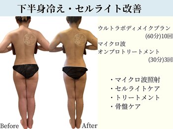 京都フォーエイチ(京都4H)/露出が増える夏前のサイズダウン
