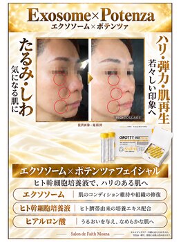 サロン ド フェイス モアナ(Salon de Faith Moana)/エクソソーム×ポテンツァ