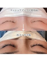 ミニョンアイラッシュ(mignon eyelash)/ビフォーアフター