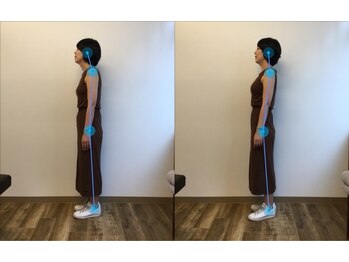 神保さるがく整骨院/骨盤矯正ビフォーアフター　30代