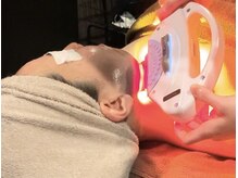 ラグーナ(Laguna)/BBLフェイシャル