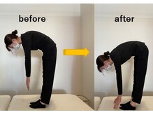 つばき接骨院/驚きの効果で◎