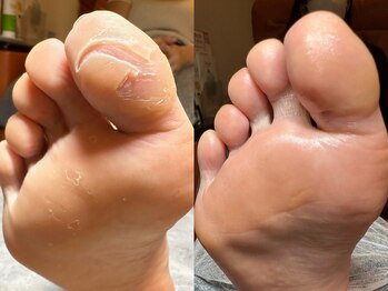 ラウン Nail salon Roun/ドイツ式フットケア