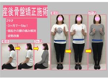茨木いで整体院/産後骨盤矯正施術