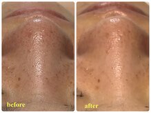 ベルドア(Bell Door)/肌改善