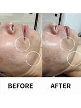 ビーンズ(BEANS)/ララピール