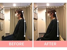 北浦和整体院/骨盤矯正で姿勢が変わる！