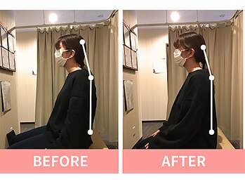 北浦和整体院/骨盤矯正で姿勢が変わる！