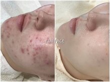 お客様before→afterをーご紹介♪お気軽にサロンにお問い合わせもお待ちしております★