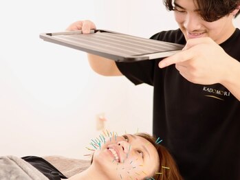 カドモリ 四ツ橋(KADOMORI)の写真/【話題沸騰！感動のハリネズミ美容鍼】初心者～美容マニアも速効×持続性にリピート急増★まずは初回体験！