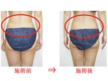 東京美容整体/ダイエット痩身 30代女性