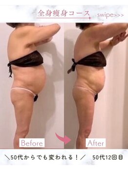 ビューティエン(beauty EN)/痩身ダイエットマッサージエステ