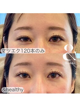 リム(Lim)/右目の変化に注目！！