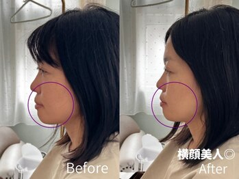 ミラ 中央林間(mira)/小顔　毛穴　美肌　横顔美人
