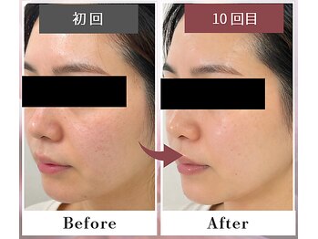 フルリール/【UVプロテクション】